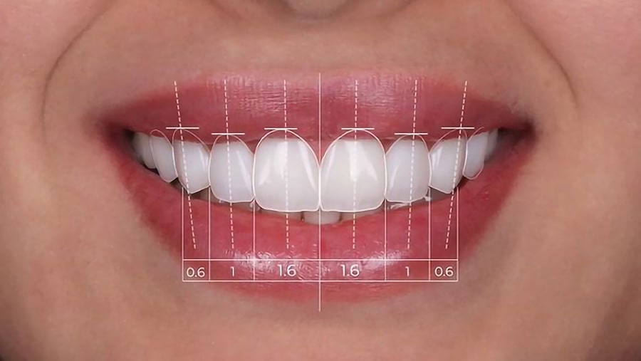 list item image